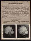 Cranio-Cerebral Topography - no. 3